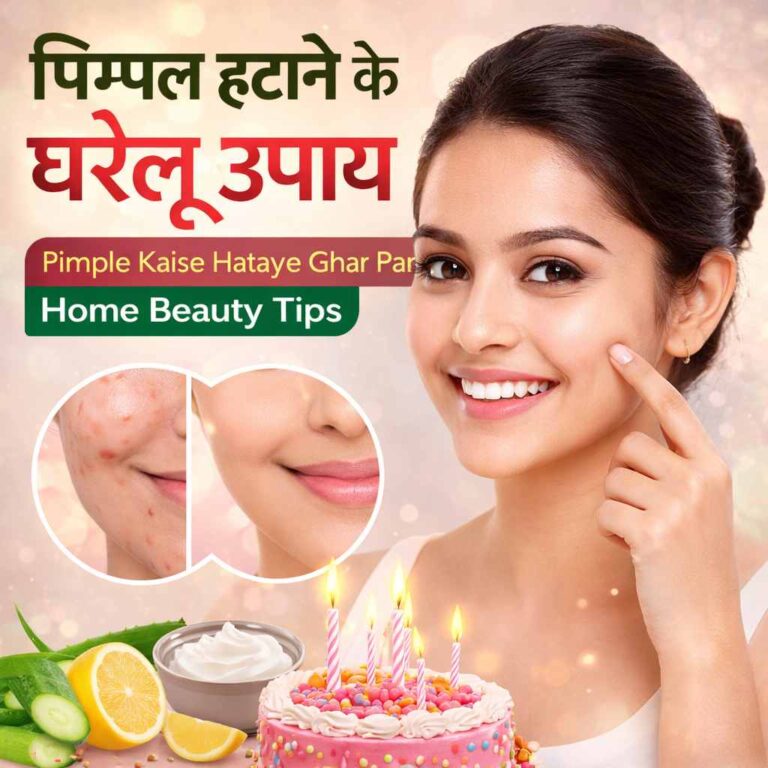 Pimple Kaise Hataye Ghar Par in Hindi